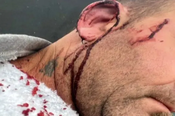 Escándalo político en Entre Ríos: un intendente acusó a un concejal de agredirlo a golpes