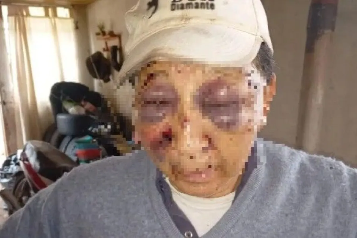 Murió el hombre de 70 años que había sido golpeado durante un asalto en Concordia